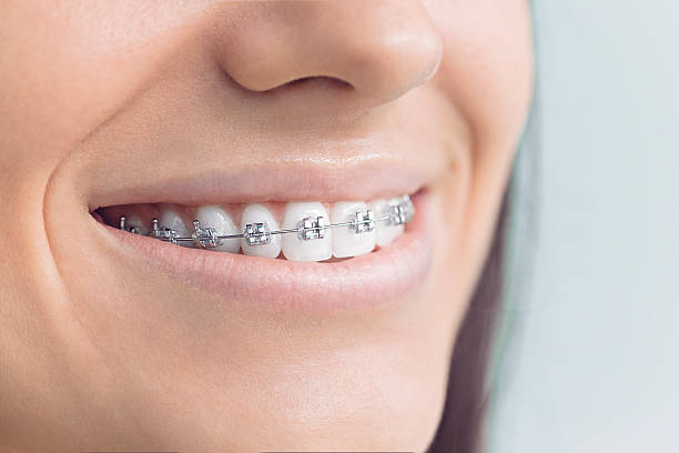 Best Wisdom Tooth Removal  in Oceana, WV
